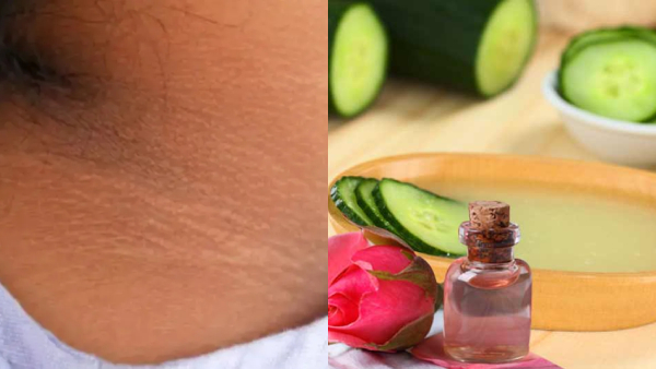 How To Remove Neck Darkness How To Remove Neck Darkness