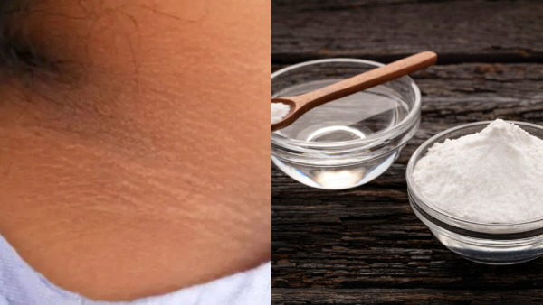 How To Remove Neck Darkness How To Remove Neck Darkness