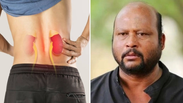 Fish Venkat Death Reason