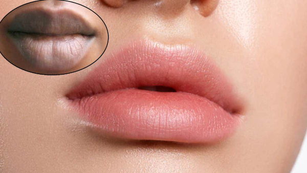 lip care in monsoon lip care in monsoon