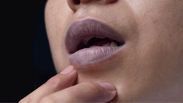 lip care in monsoon lip care in monsoon