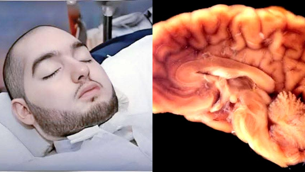 Sleeping Prince Death