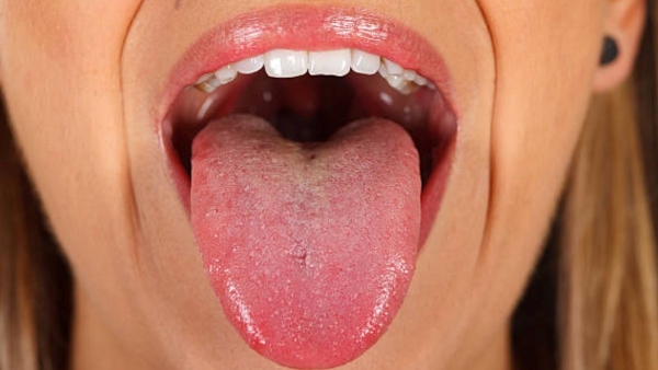 Tongue s Color Tells About Your Health Problems