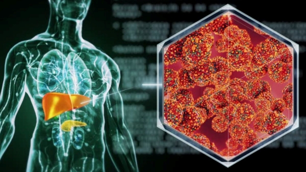 atty Liver Without Alcohol