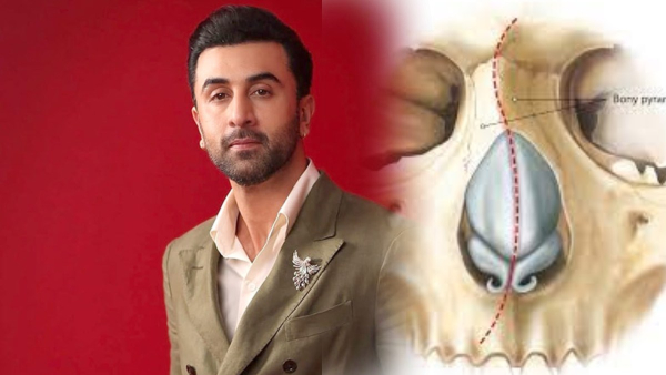 ranbir kapoor suffered from nasal septum