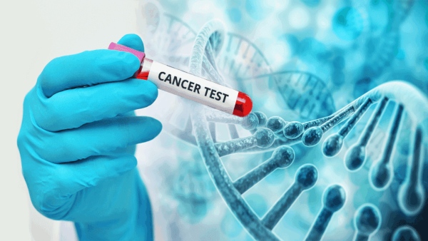 Cancer Tests