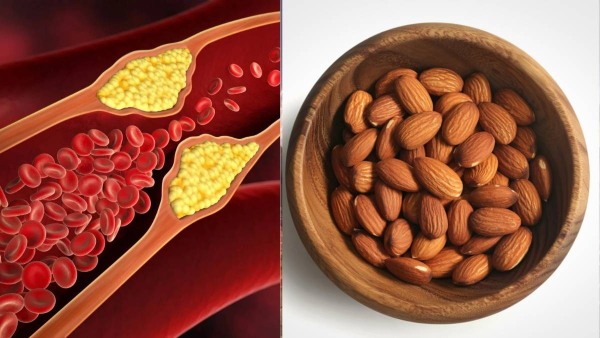 Foods To Lower Bad Cholesterol