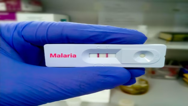 Malaria Test