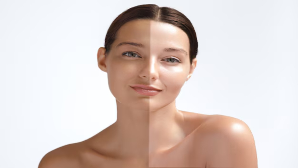 Tanning Home Remedies