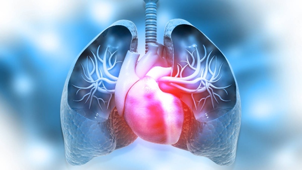 Pulmonary Hypertension