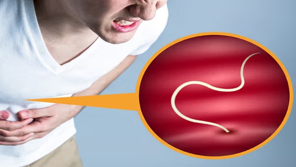 Stomach Worms Home Remedies