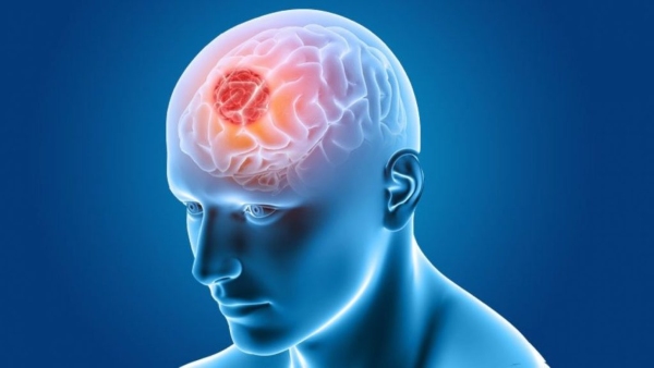 Brain Tumor Sympotms Brain Tumor Sympotms
