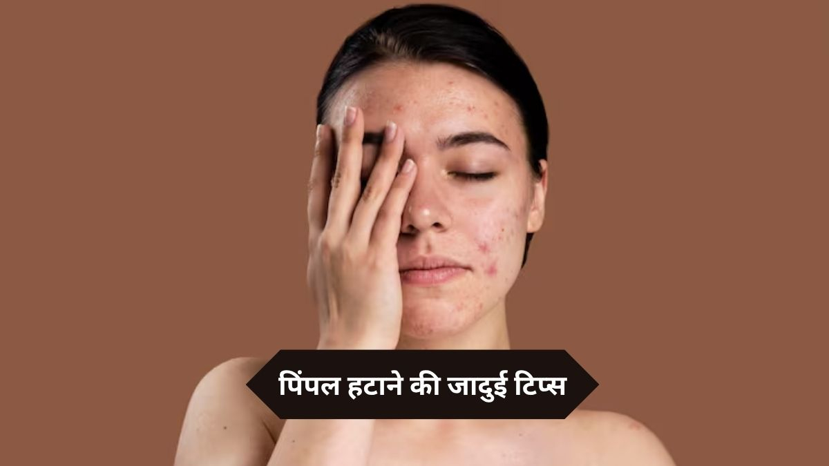 रातभर में गायब हो जाएंगे चेहरे के जिद्दी व भद्दे पिंपल्स, बस आजमा कर देखें ये 7 जादुई टिप्स