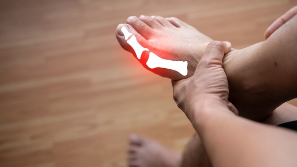 Uric Acid Pain Area