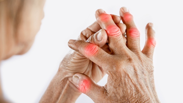 What Not To Eat In Arthritis
