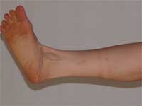 Ankle Rotation