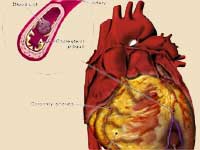 Heart Diseases Not Always Show Symptoms Heart Diseases Not Always Show Symptoms