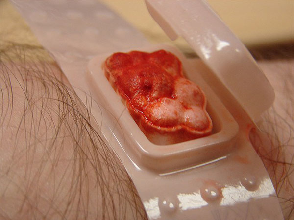 Lick Your Wounds Lick Your Wounds