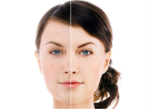 Prevents Pigmentation And Dry Skin