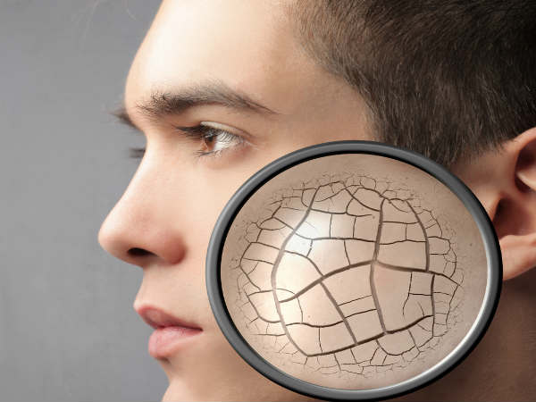 Dry Skin Becomes Vulnerable