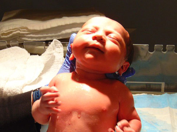 #Story 8: Delivering Baby girl