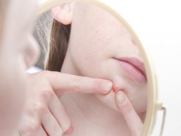 Do You Love To Pop Pimples