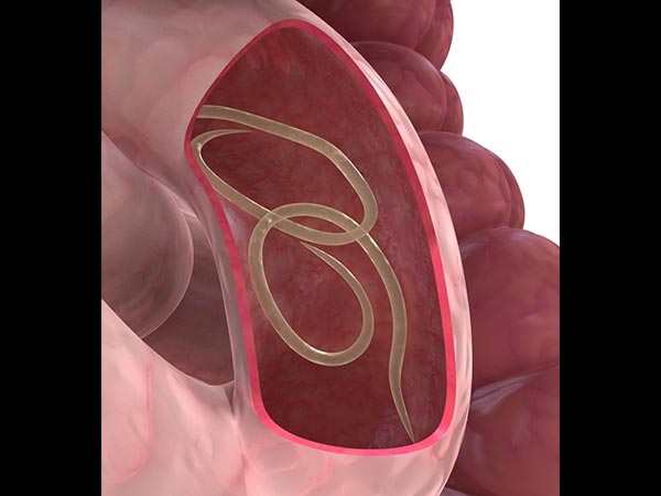 How Intestinal Parasites Enter The Body?