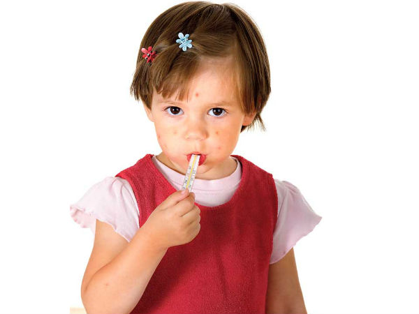 Can Home Remedies Treat Measles?