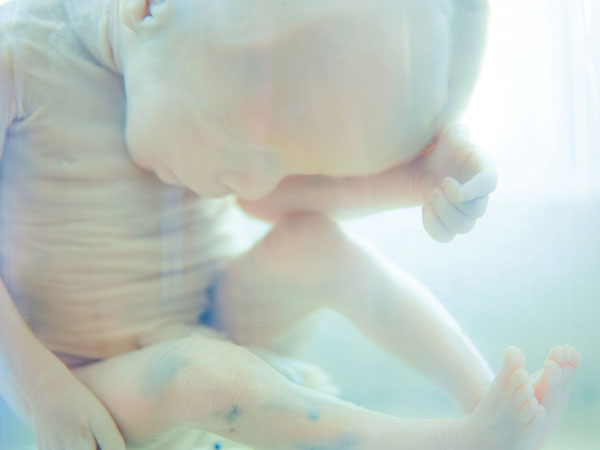 period after a miscarriage