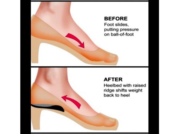 Usage Of Extra Support