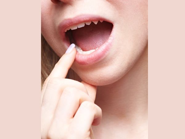 side effects of drinking diet soda