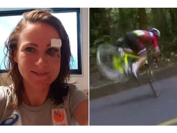 List of people who have injured themselves List of people who have injured themselves