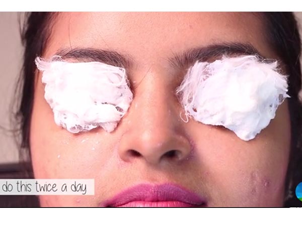 home remedies for itchy eyes