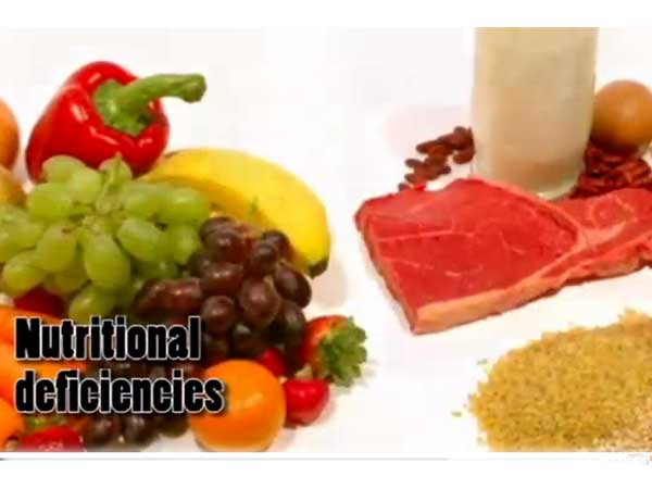 dieting and health problems