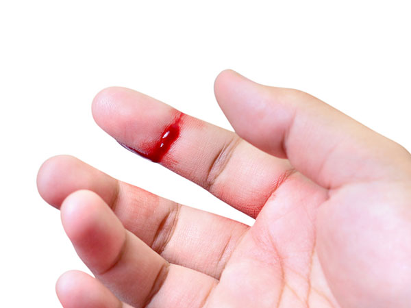 Blood related diseases