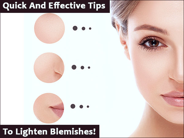 blemishes blemishes