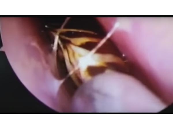 She Woke Up In Pain!