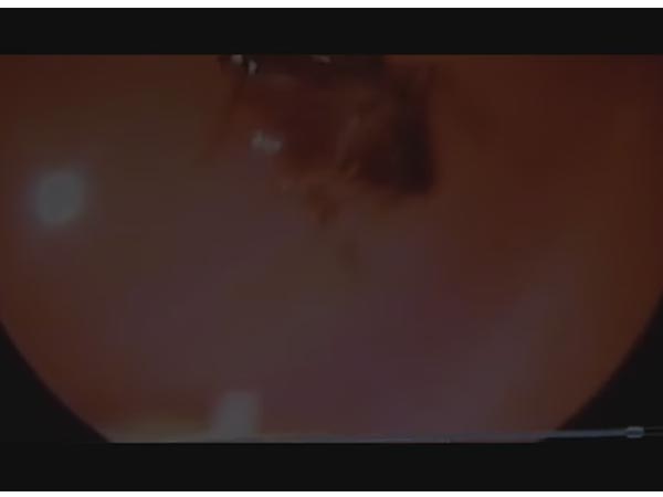 Scans Revealed The Worst Nightmare One Could Ever Imagine!