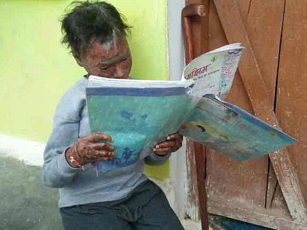 Her Condition Is Called Erthroderma