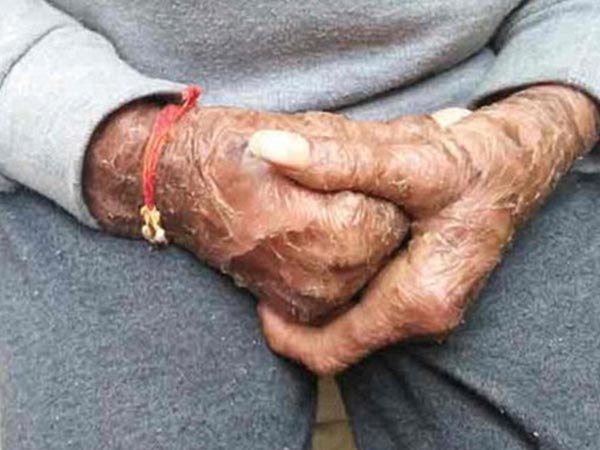 She Has been Suffering Since Childhood