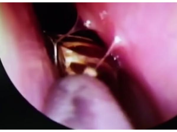 Live Cockroach
