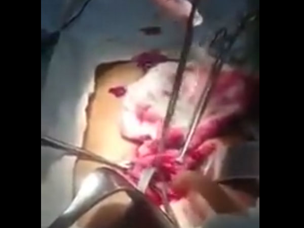 There Were Not Only Toothbrushes!