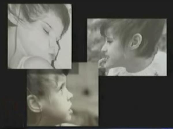 They Received Cochlear Implants