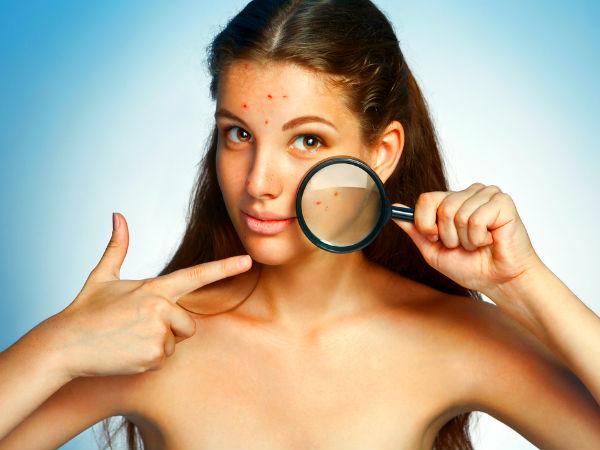 what are derma rollers