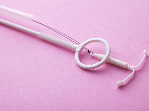 The Doctors Could Not Remove The IUD…