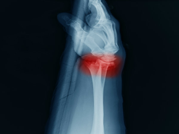 1. Inflammatory Damage: