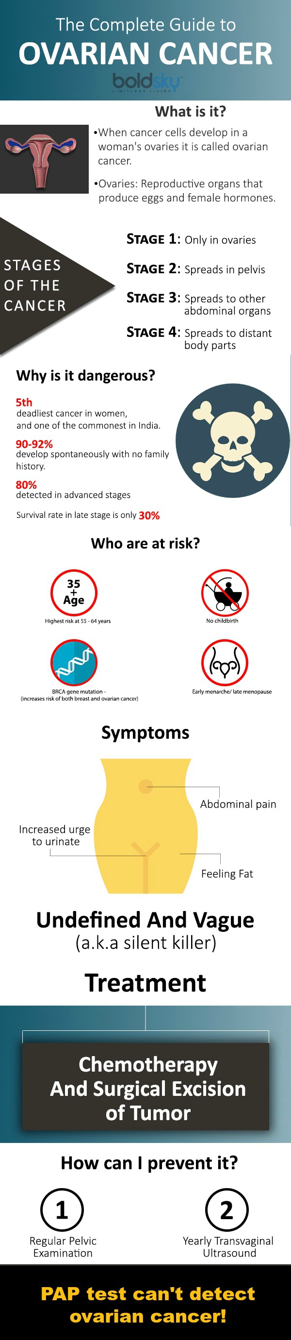complete guide to ovarian cancer
