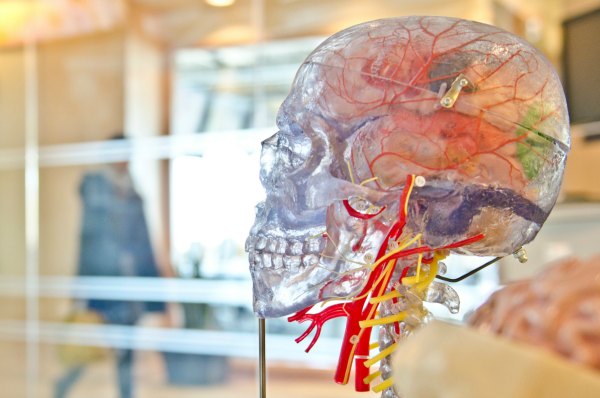 Linked to brain diseases