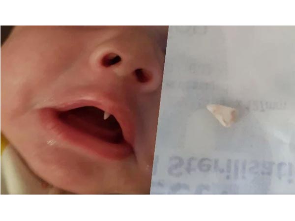 Baby Grows Fang Tooth Overnight Baby Grows Fang Tooth Overnight
