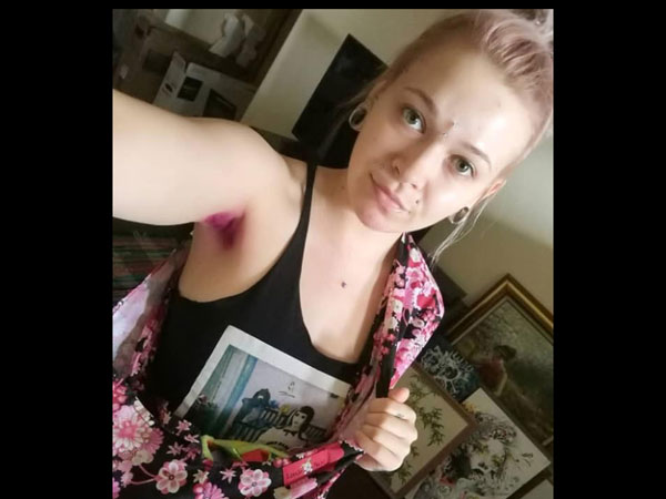 She Hopes To Reduce The Stigma 